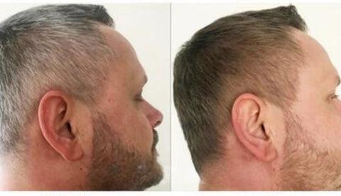 Sérum anti-cheveux gris au charme intemporel