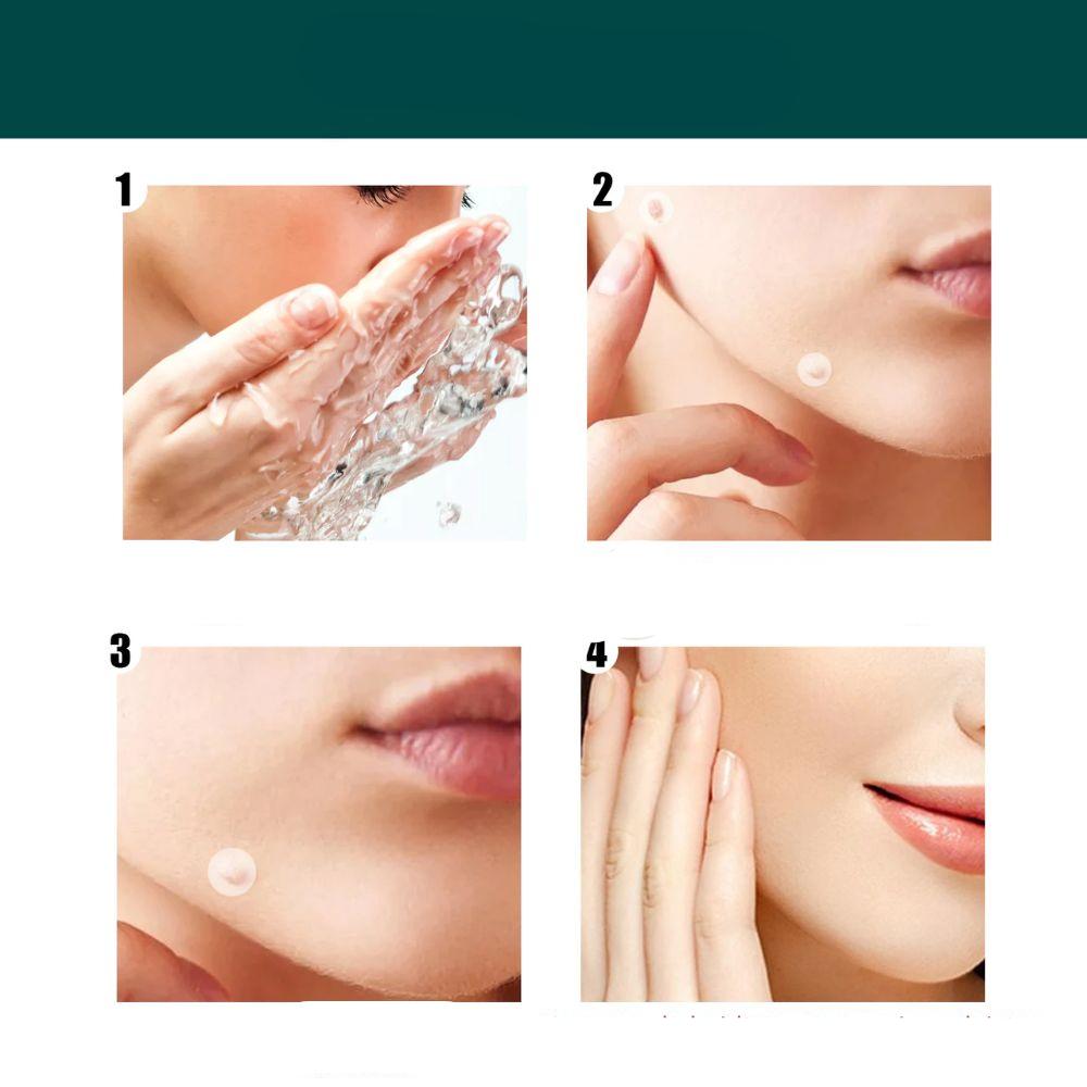 SkinClear - Élimination des taches et des verrues