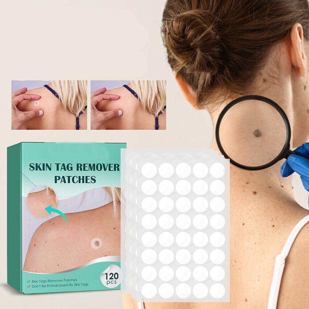 DermaClear – Ensemble de traitement efficace contre les boutons et les verrues