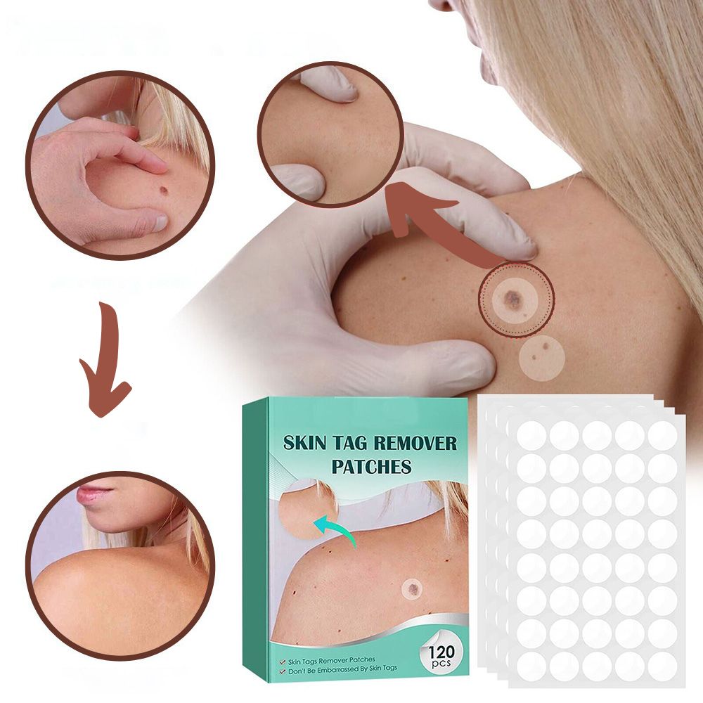 DermaClear – Ensemble de traitement efficace contre les boutons et les verrues