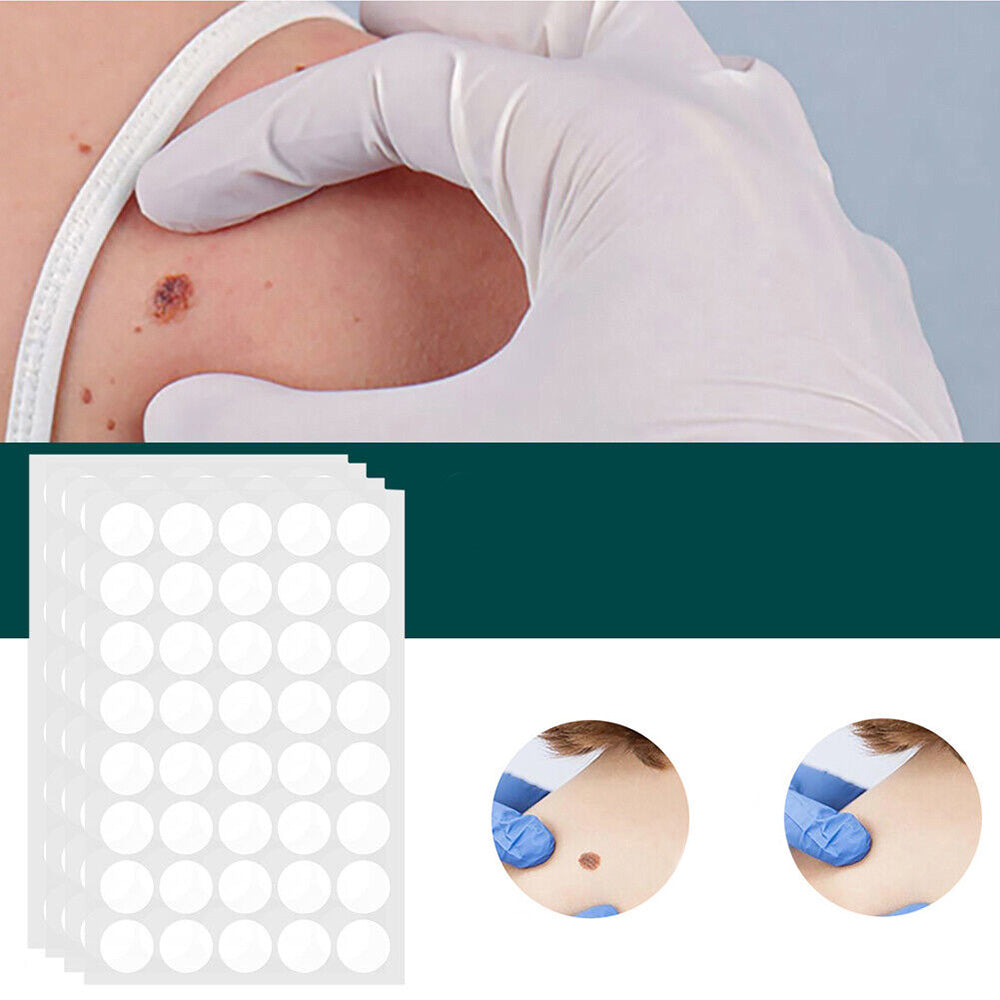 DermaClear – Ensemble de traitement efficace contre les boutons et les verrues